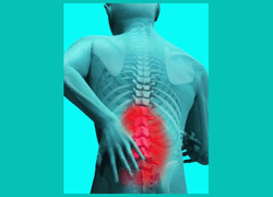 Herniated Disc - Herniated Disc