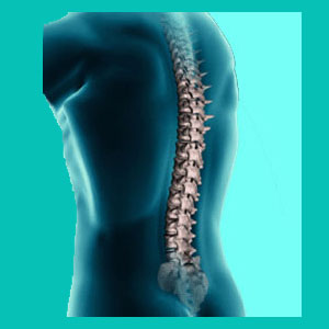 What is it Like to Have a Herniated Disc?